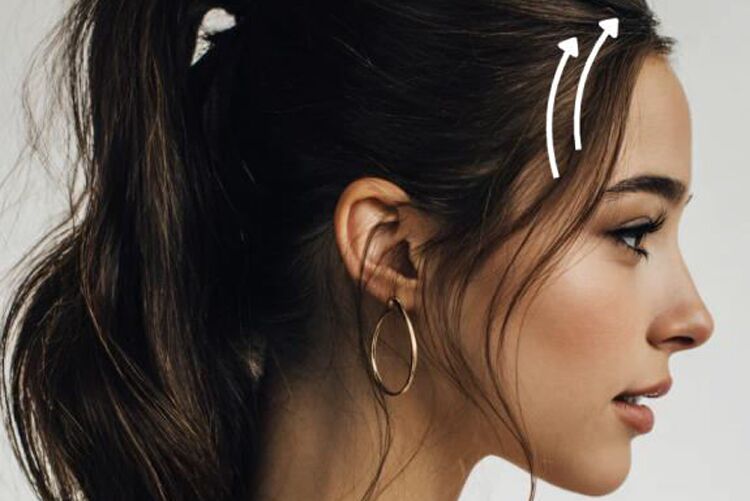 Ponytail Lift Dresden | Endoskopisches Lifting – präzise und gewebeschonend