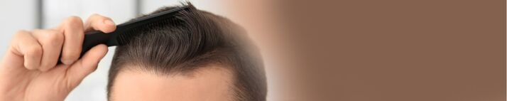 Symbolbild für Haartransplantationen: Mann kämmt frisch transplantiertes Haar